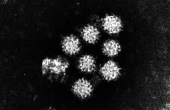 図　ノロウイルスの電子顕微鏡像 （写真提供：元国立感染研究所感染症情報センター　松野重夫主任研官）