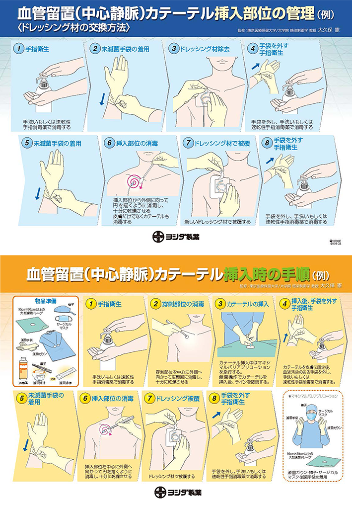 血管留置（中心静脈）カテーテル挿入時の手順／挿入部位の管理